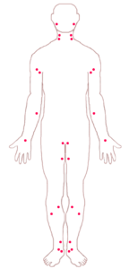 How to control bleeding