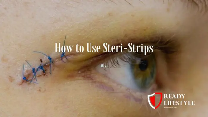 How to Use Steri-Strips