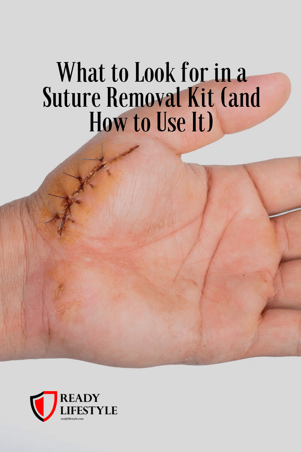 What to Look for in a Suture Removal Kit (and How to Use It) Ready